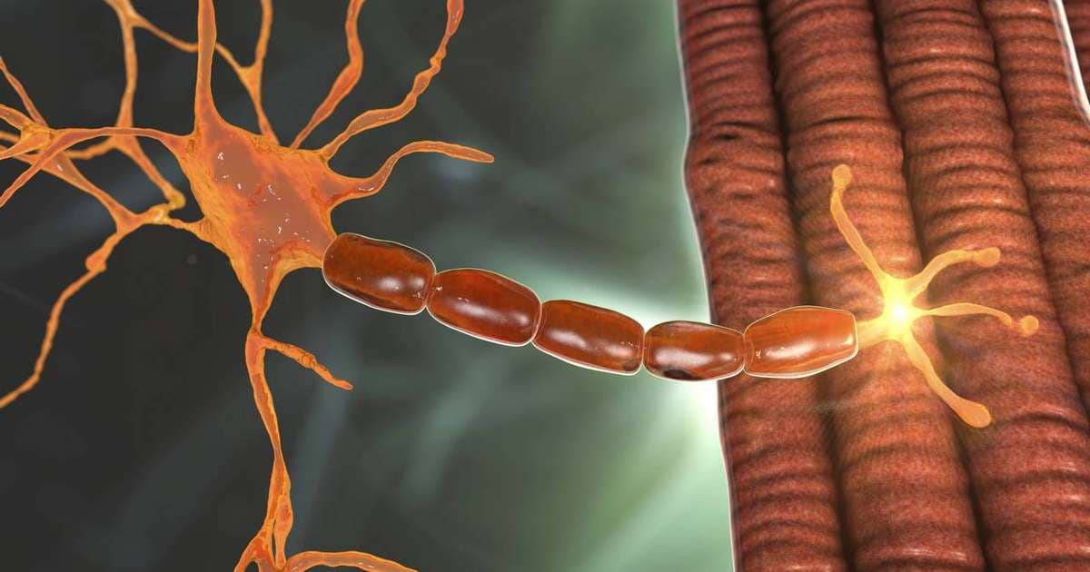 Miastenia Gravis: A Doença Silenciosa que Afeta os Mais Pobres